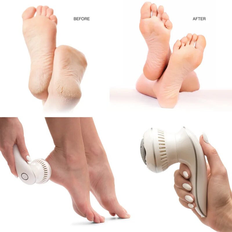 RIO 60 Second Spa Pedi 3 odstranjevalec žuljev 1 kos