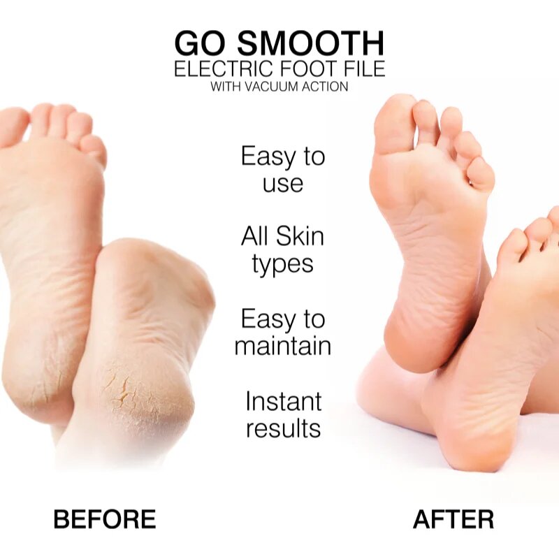 RIO Go Smooth Vacuum Action električna pila za stopala 1 kos