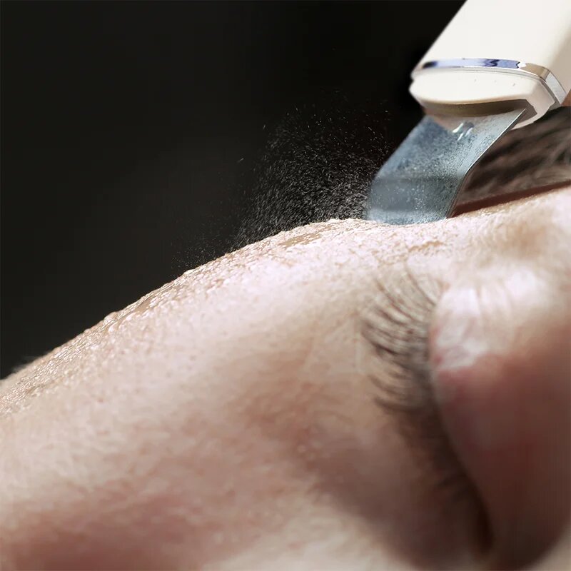 RIO Ultrasonic Skin Cleanser večnamenska ultrazvočna lopatka 1 kos