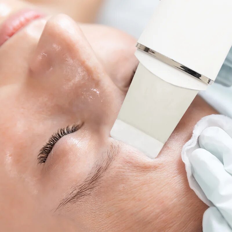 RIO Ultrasonic Skin Cleanser večnamenska ultrazvočna lopatka 1 kos