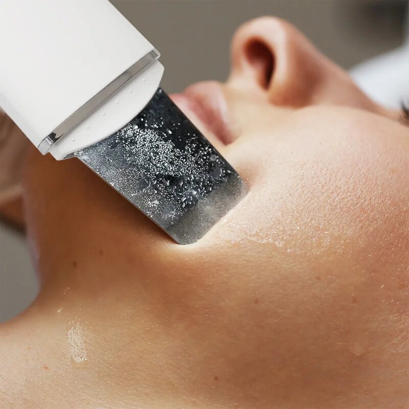RIO Ultrasonic Skin Cleanser večnamenska ultrazvočna lopatka 1 kos