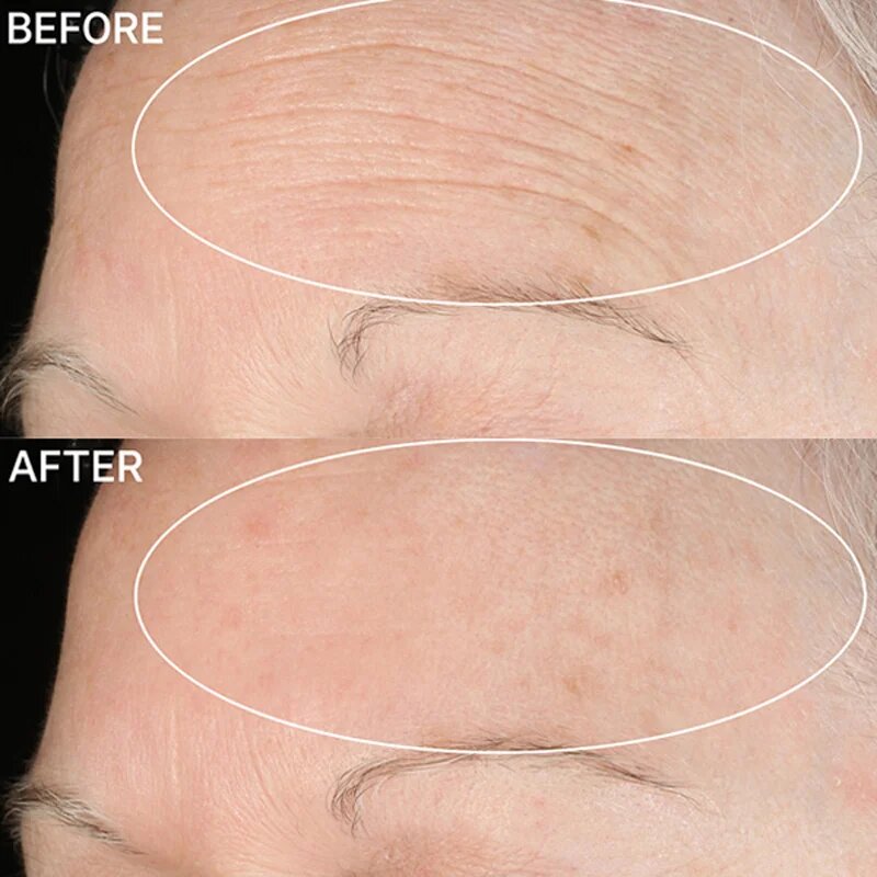 StriVectin Anti-Wrinkle SD Advanced Plus koncentrirana krema za redukcijo gub 118 ml