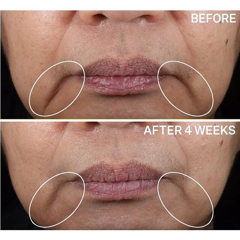 StriVectin Contour Restore™ Tightening & Sculpting Face Cream ultra lifting krema za obraz 50 ml