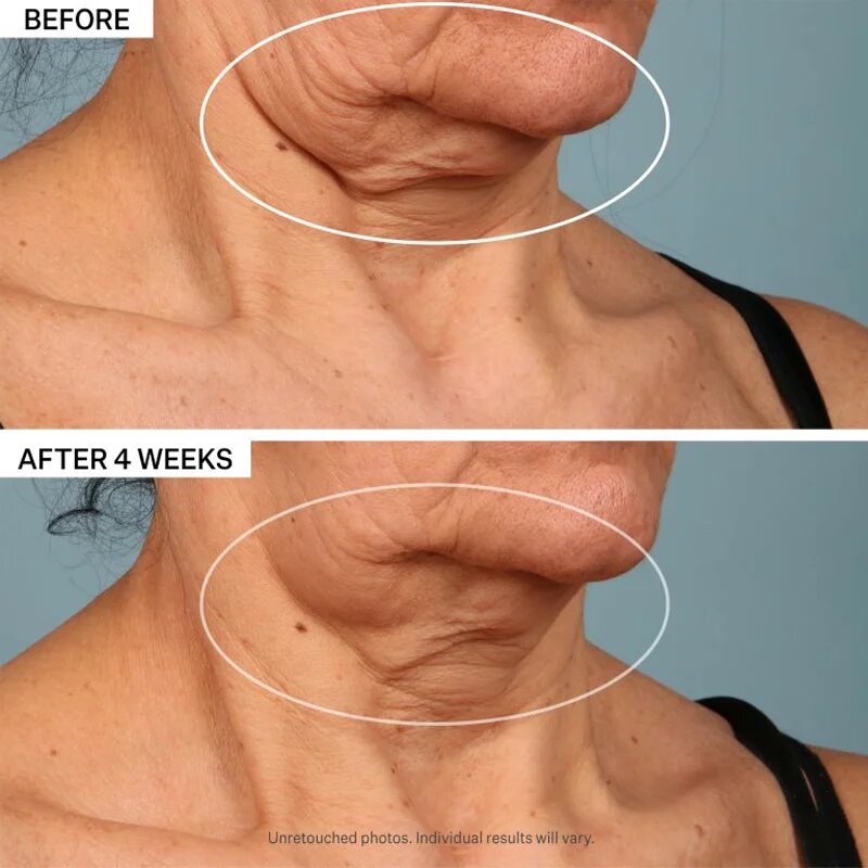 StriVectin Tighten & Lift TL Advanced Tightening Neck Cream Plus učvrstitvena lifting krema za vrat in dekolte 30 ml