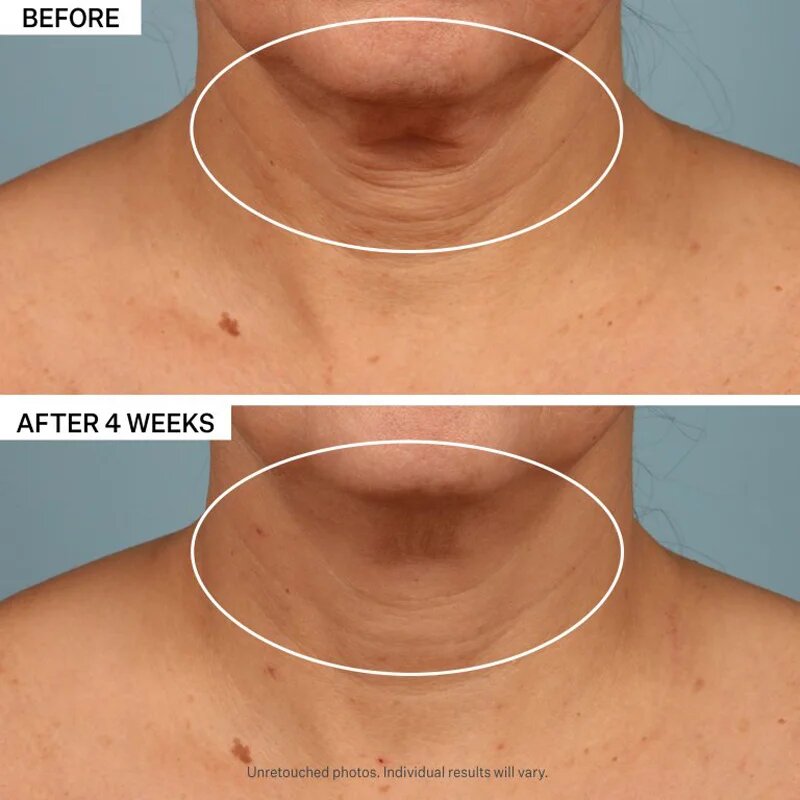 StriVectin Tighten & Lift TL Advanced Tightening Neck Cream Plus učvrstitvena lifting krema za vrat in dekolte 50 ml