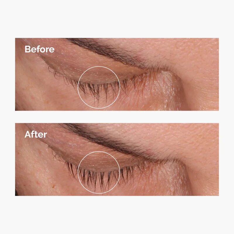 The Ordinary Multi-Peptide Lash and Brow Serum serum za trepalnice in obrvi 5 ml