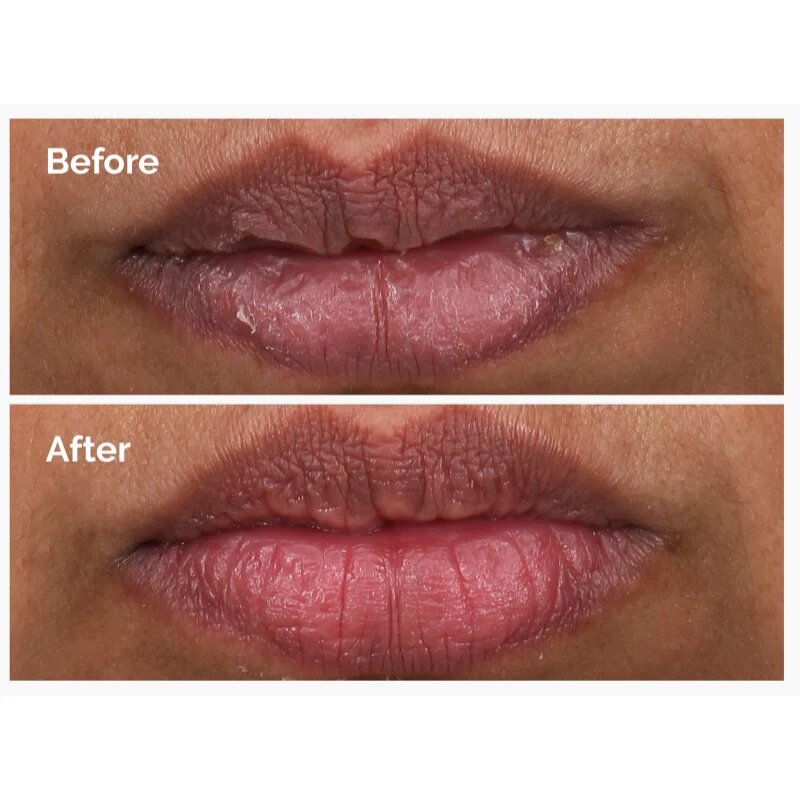 The Ordinary PHA 5% Exfoliating Lip Serum gladilni eksfoliacijski serum za ustnice 15 ml
