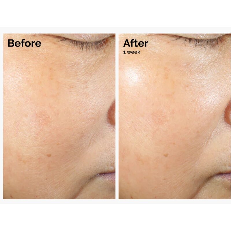 The Ordinary Rice Lipids + Ectoin Microemulsion lahka vlažilna emulzija za pomiritev kože 60 ml