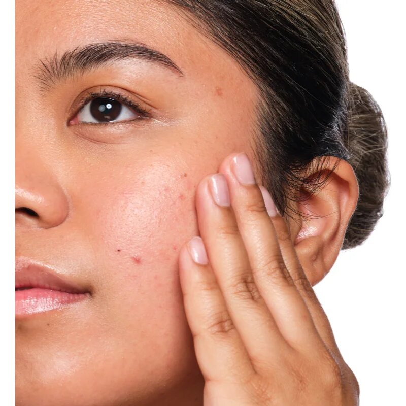 The Ordinary Salicylic Acid 2% Solution serum s salicilno kislino 30 ml