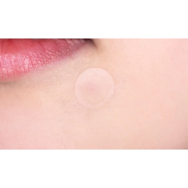 VT Cosmetics Cica Spot Patch obliži za problematično kožo 48 kos