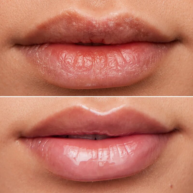 WONDERSKIN Lip Rehab Therapy Oil olje za ustnice z vlažilnim učinkom odtenek Clear 357 ml