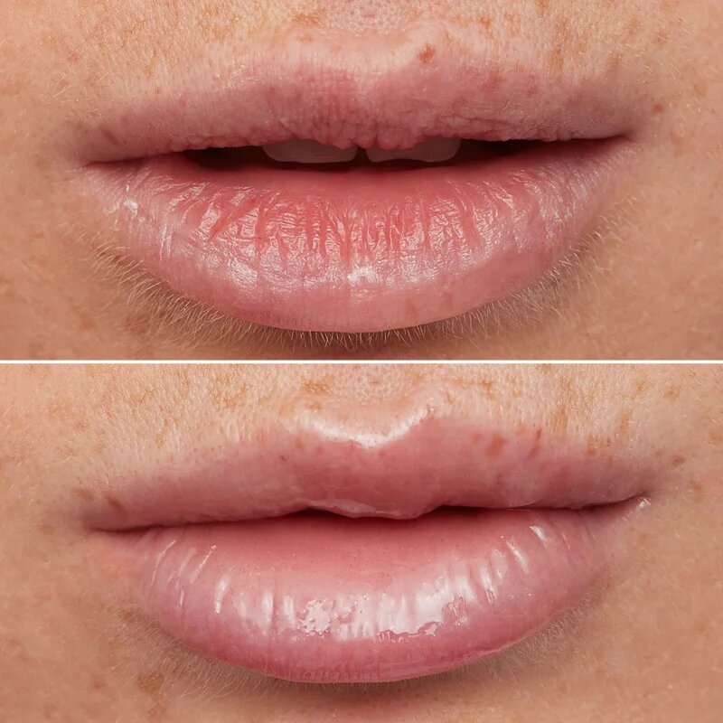 WONDERSKIN Lip Rehab Therapy Oil olje za ustnice z vlažilnim učinkom odtenek Clear 357 ml
