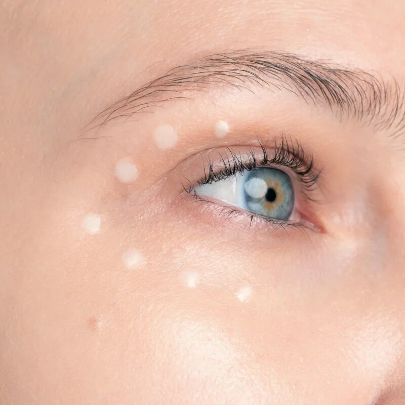 Yonelle Infusíon Lift Pro-Lift Ultimate Eye Cream lifting krema za predel okoli oči 15 ml